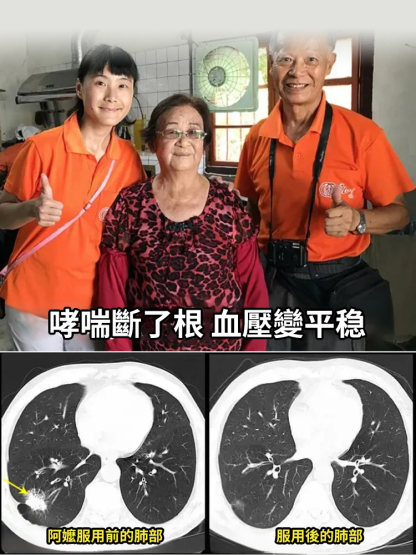 從根源清肺消結草本固金湯
