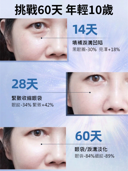黃耆緊緻抗皺眼霜
