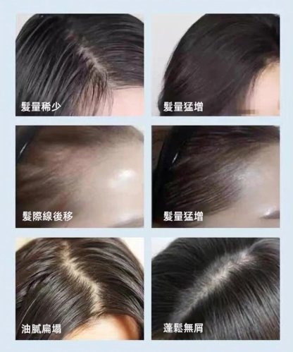 苗疆秘方養髮密髮防除洗髮乳