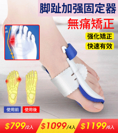 夜用拇指矯正帶
