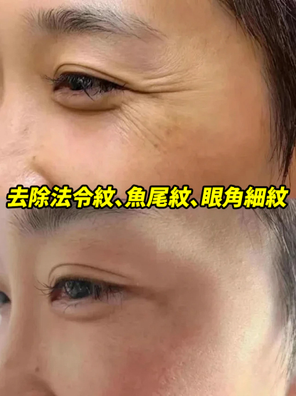 黃耆草本抗皺凝霜