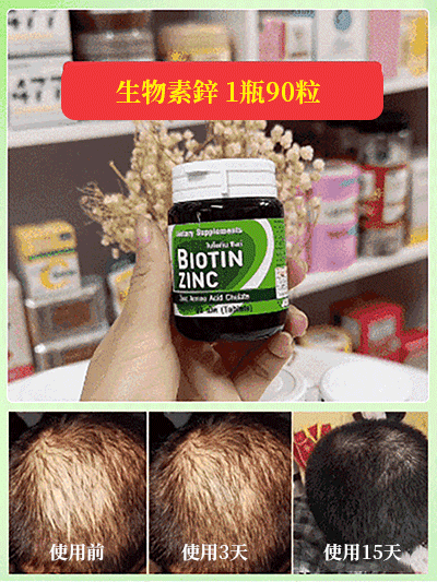 【泰國熱賣中】防脫神器補鋅片