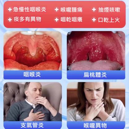 【拒絕咽喉炎反覆】李時珍咽扁凝膠