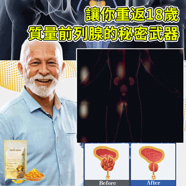 前列康膠囊