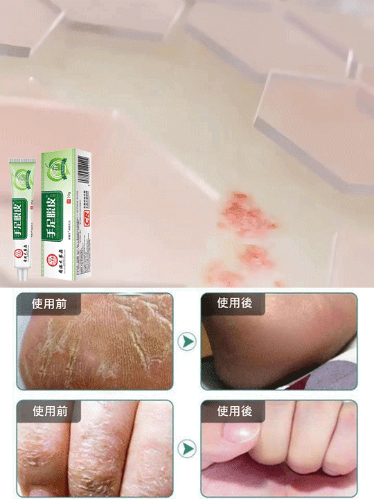 香港大藥房手足脫皮護膚膏