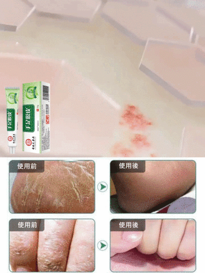 香港大藥房手足脫皮護膚膏