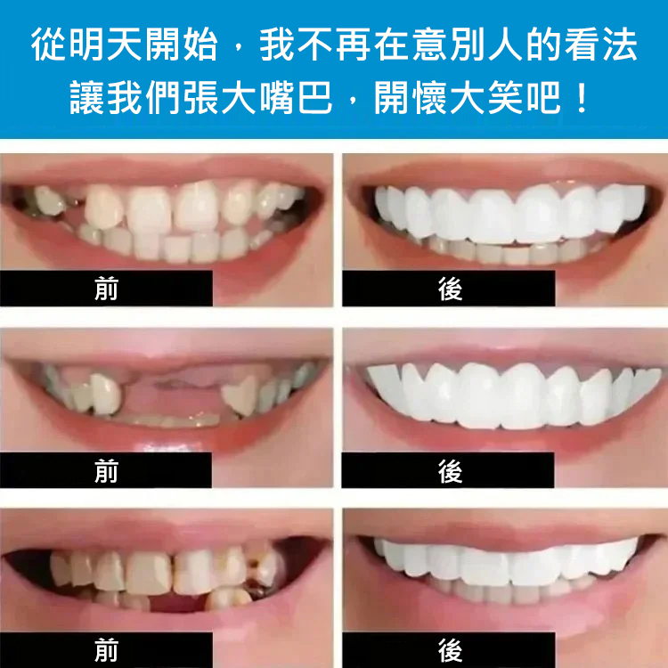 完美微笑假牙套裝