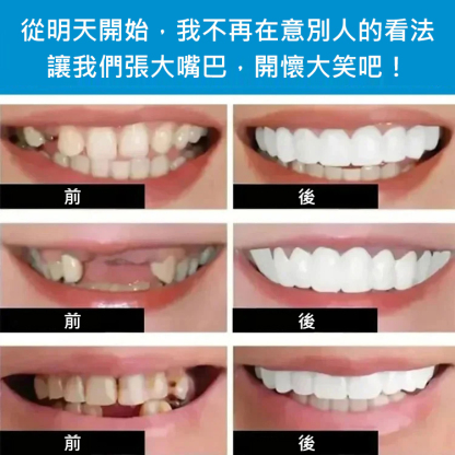 完美微笑假牙套裝