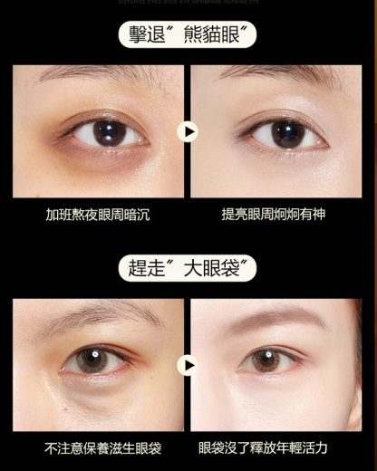 【重返20歲】 龍膽抗皺眼霜