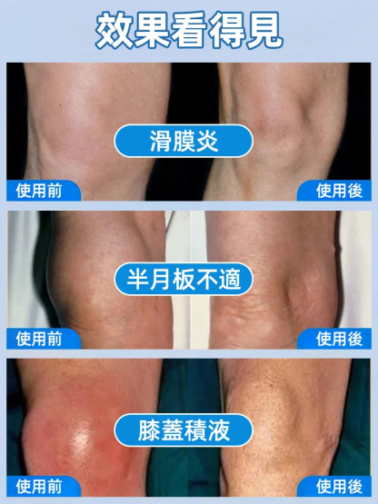 香港大藥房氨糖軟骨貼