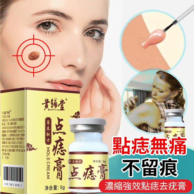 濃縮強效點痣去疣膏