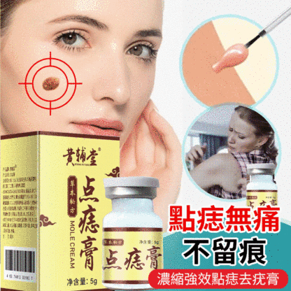濃縮強效點痣去疣膏