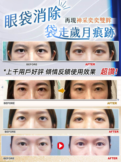 4週消眼袋抗皺扶紋緊緻眼貼