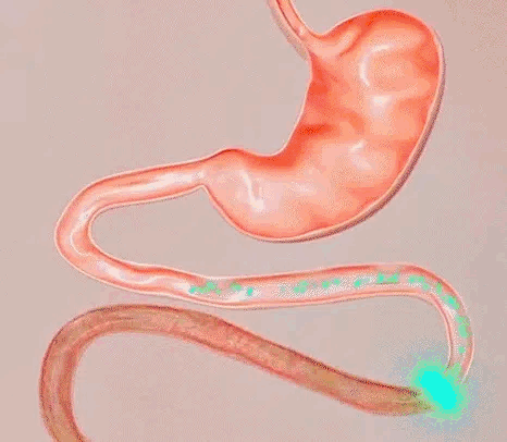 18.gif