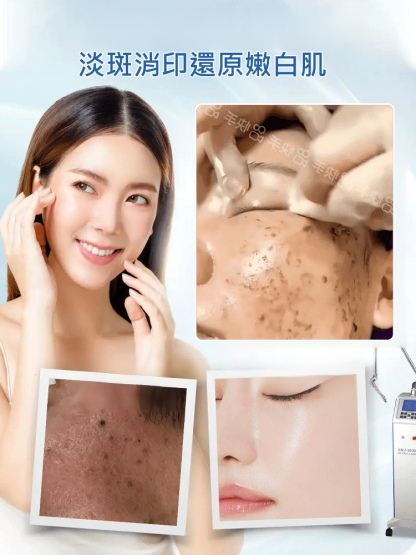 【老斑黃斑一抹消】淡斑尿素霜