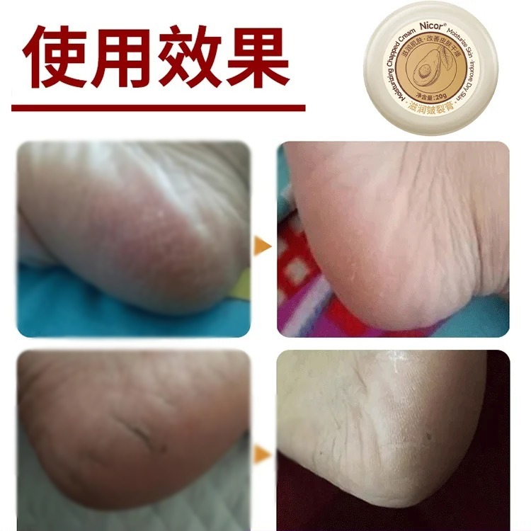 【草本滋潤】皴裂膏防乾防凍防裂膏