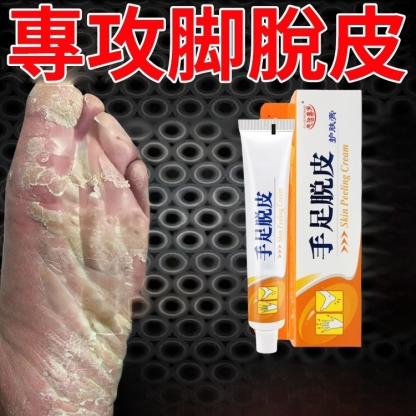 【脫皮專用】手足脫皮抑菌膏