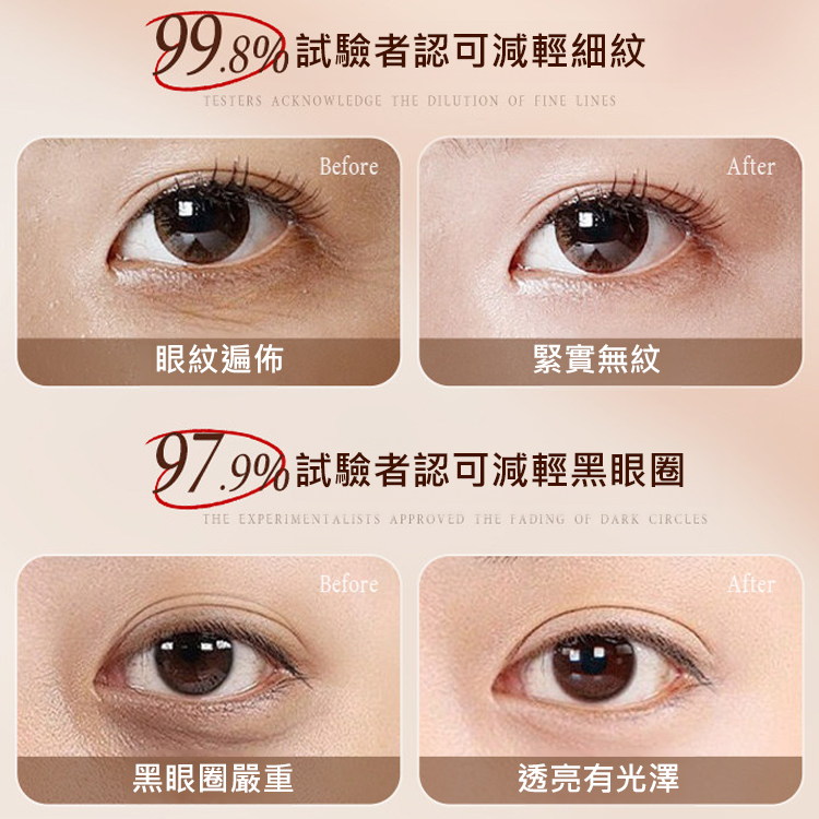 【回到20歲】抗皺緊緻眼部精華油