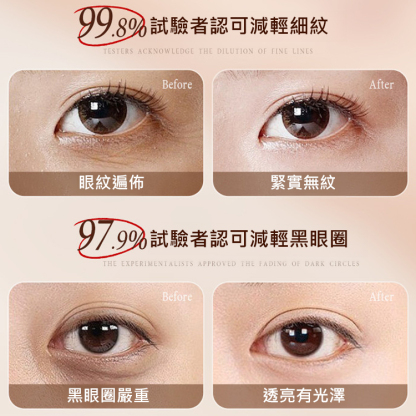 【回到20歲】抗皺緊緻眼部精華油