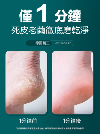 去死皮防飛濺搓脚神器