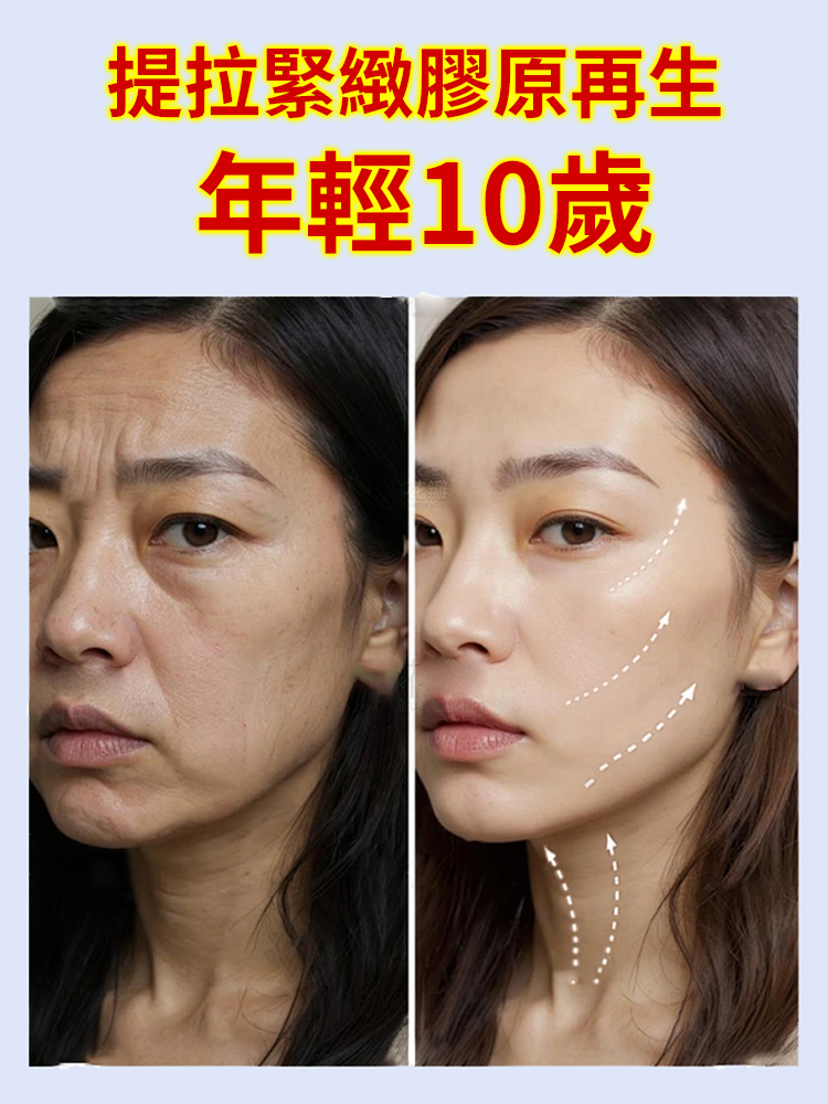 【1秒提拉】電動美容儀