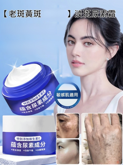 【老斑黃斑一抹消】淡斑尿素霜