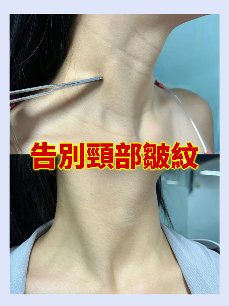 【1秒提拉】電動美容儀