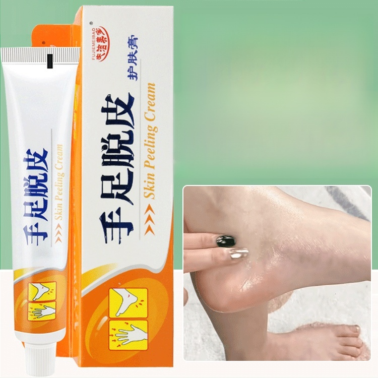 【脫皮專用】手足脫皮抑菌膏