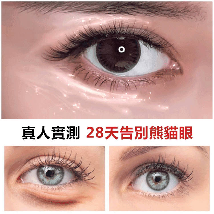 【回到20歲】抗皺緊緻眼部精華油