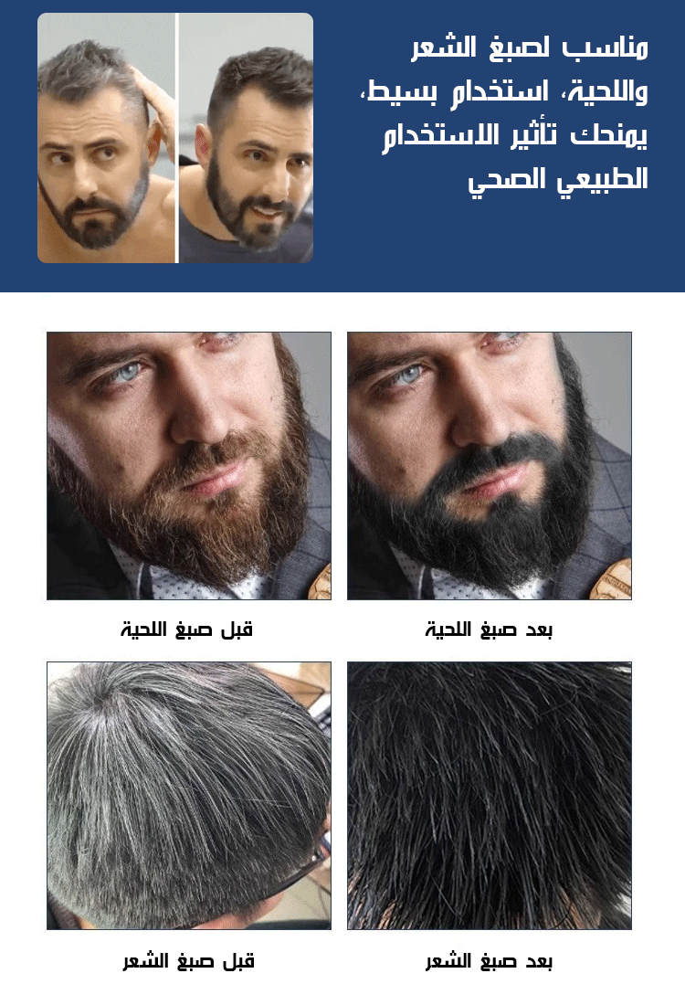 صبغة الشعر واللحية من مستخلصات نباتية طبيعية ( صبغ الشعر واللحية إلى اللون الأسود خلال 5 دقائق )