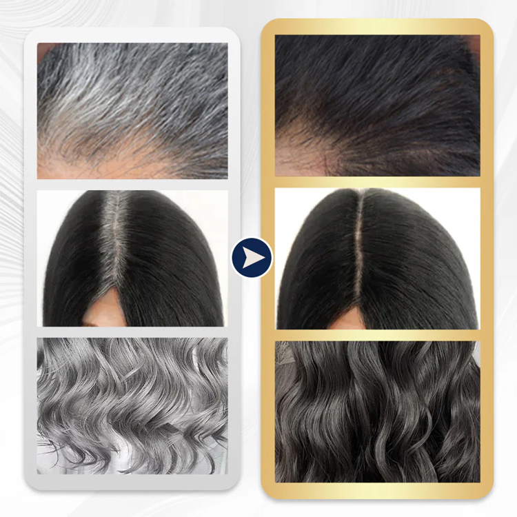 【وداعًا للشيب إلى الأبد】الصبغة الرغوية الطبيعية للشعر الأكثر رواجًا