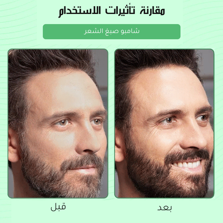 【وداعًا للشيب إلى الأبد】الصبغة الرغوية الطبيعية للشعر الأكثر رواجًا