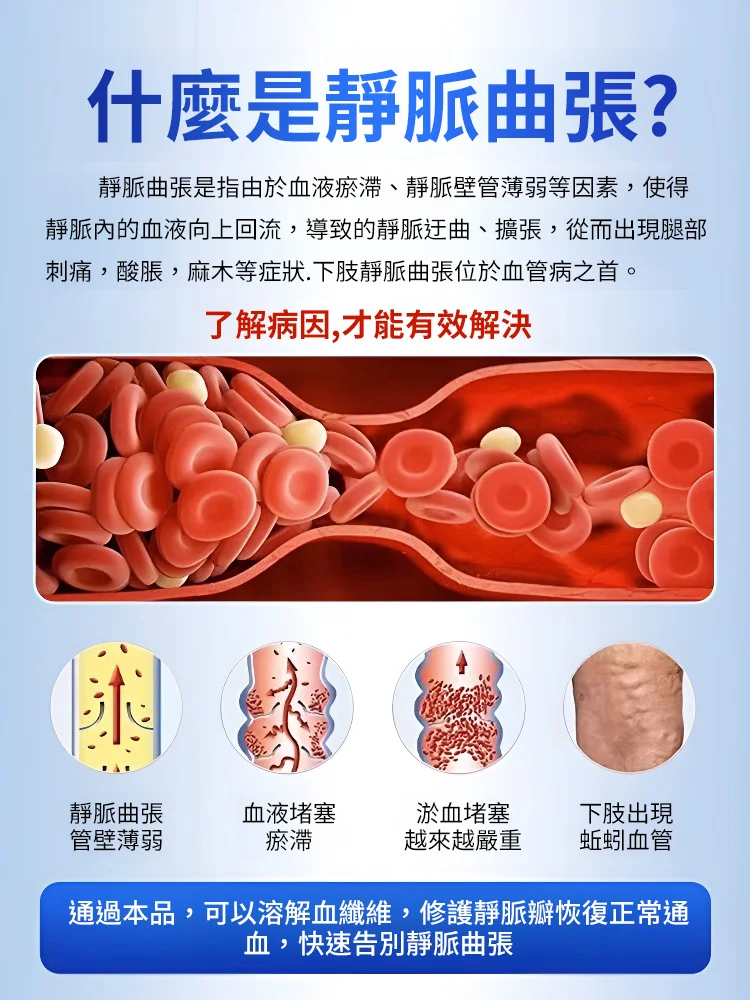 一抹疏通✦高效型靜脈曲張凝膠