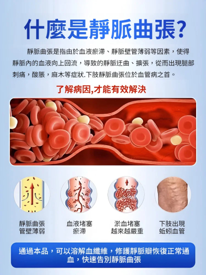 一抹疏通✦高效型靜脈曲張凝膠