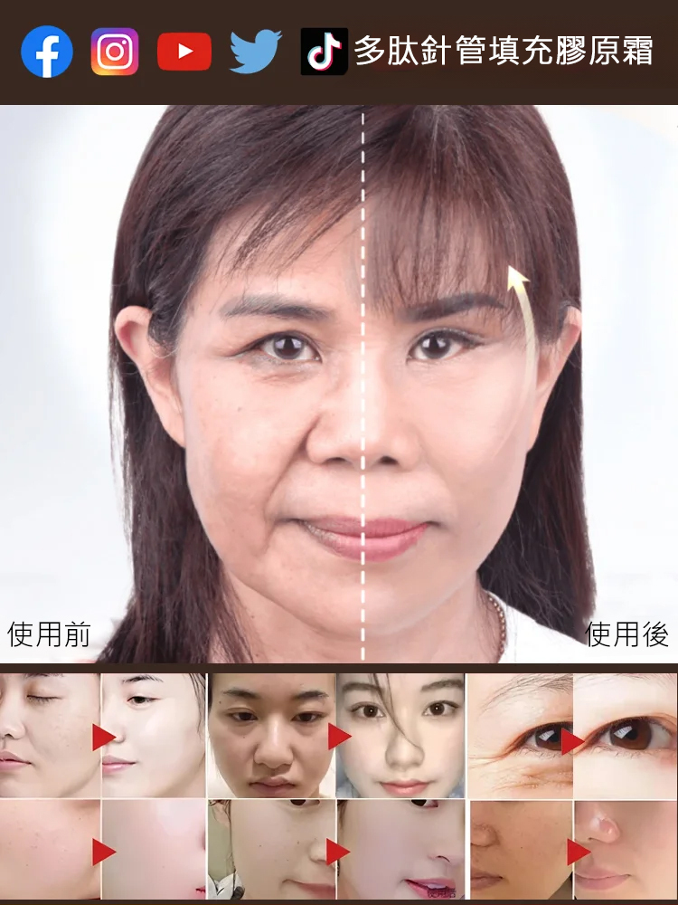 【皺紋一抹消】多肽針管填充膠原霜，皺紋消失了！高純度活性膠原蛋白專攻脂肪法令紋，深紋越頑固越見效，眼頸紋都管用，米粒量就起效，速沖！