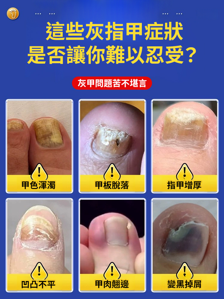 香港大藥局亮甲抑菌液
