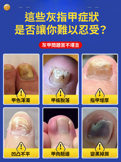 香港大藥局亮甲抑菌液
