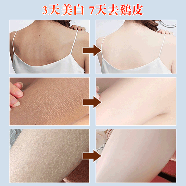 【專為秋冬研發】止癢潤膚露