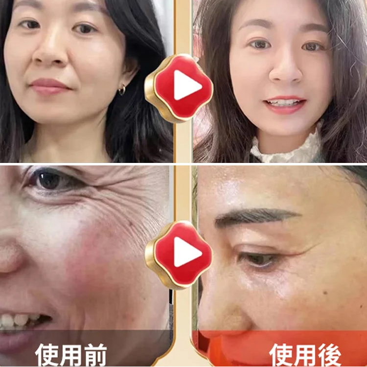 【秒去法令紋】水光逆齡噴霧🌸超輕盈抗老水基配方💧能夠深入滲透肌膚，有效淡化皺紋。