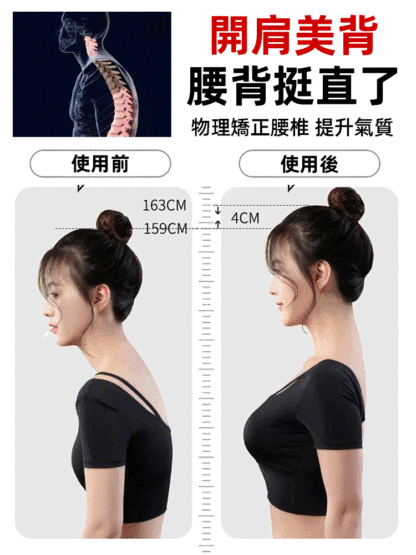 開肩美背拉力神器，幫您矯正姿勢、鍛鍊臀部、瘦腿