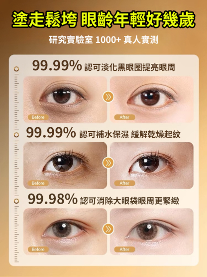 眼部黃耆精華抗皺眼部抗皺精華油（眼紋小熨斗 熬夜黨必備）
