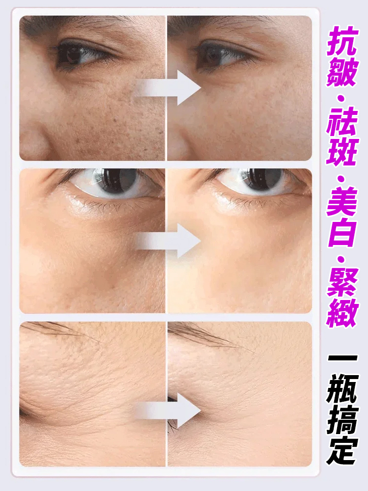 【專利去黃抗皺】黃耆乳霜