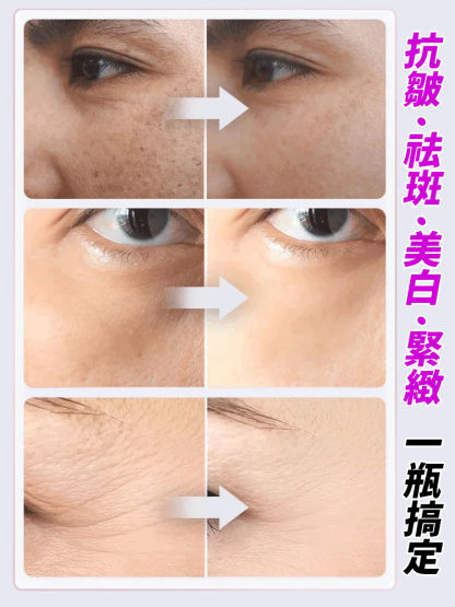 【專利去黃抗皺】黃耆乳霜