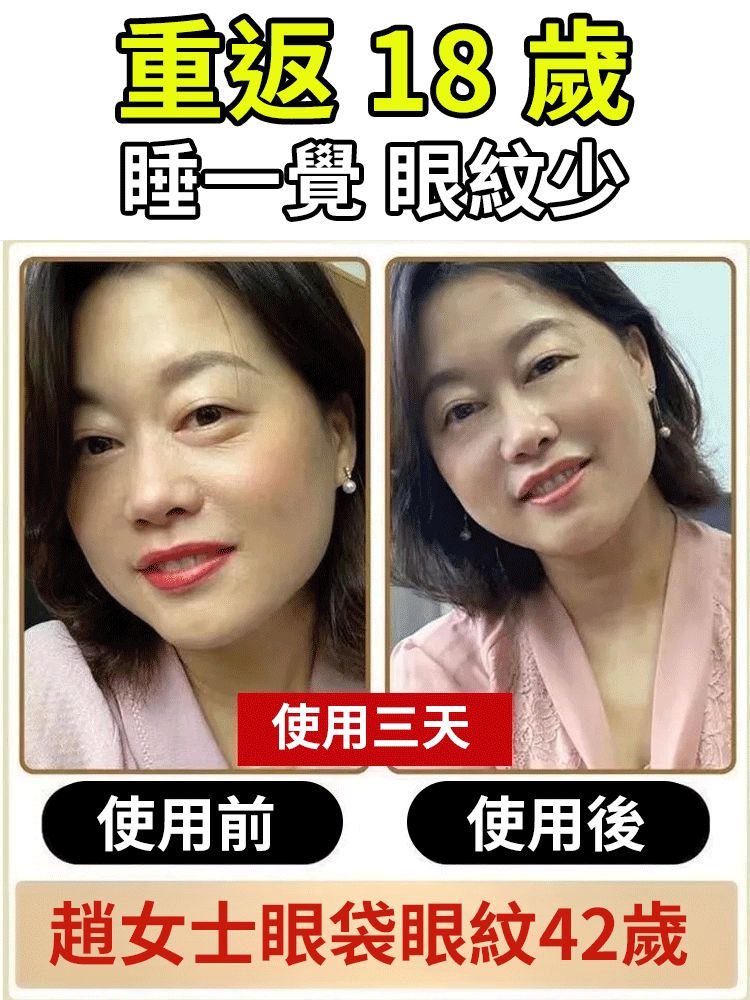 眼部黃耆精華抗皺眼部抗皺精華油（眼紋小熨斗 熬夜黨必備）
