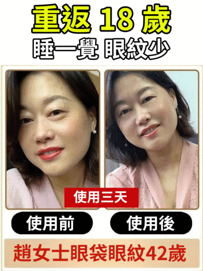 眼部黃耆精華抗皺眼部抗皺精華油（眼紋小熨斗 熬夜黨必備）