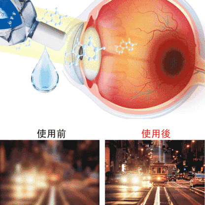 即時矯正眼睛清晰視力清滴眼液