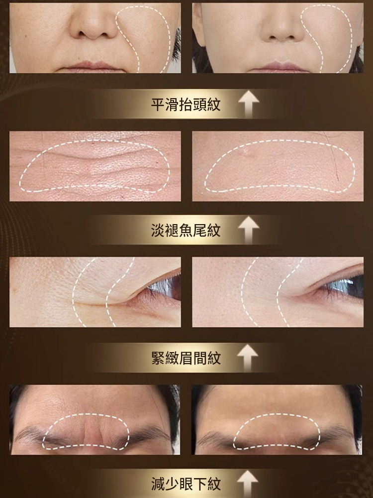 重組膠原抗皺保濕霜