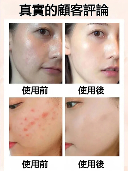 💓💓无花果香甜软糯的口感，搭配核桃的爽脆口感，成就了绝佳的口感组合。🌿 天然甜味：无添加糖