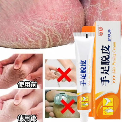 【脫皮專用】手足脫皮抑菌膏
