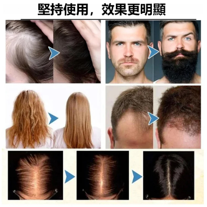 純天然迷迭香密髮精油